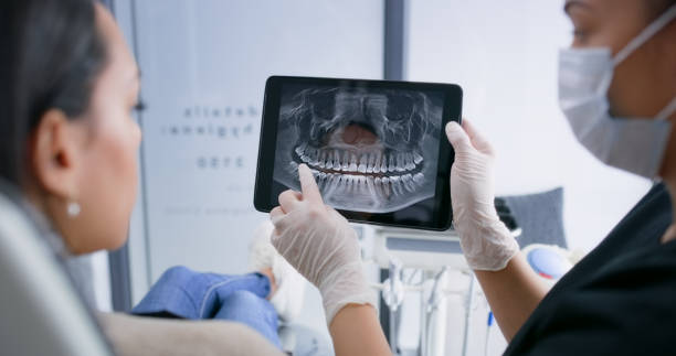 Licensed Wisdom Tooth Removal service in Mission Canyon, CA - Dentist Open Now